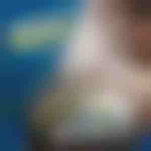 Elektronisches Reparaturhebel-Set | OPTIFIX